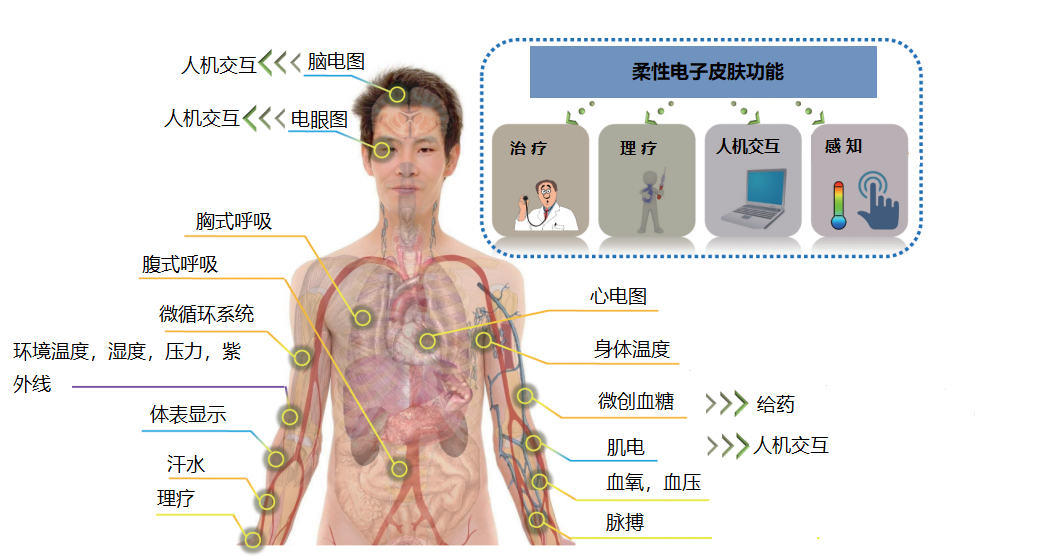 柔性电子皮肤